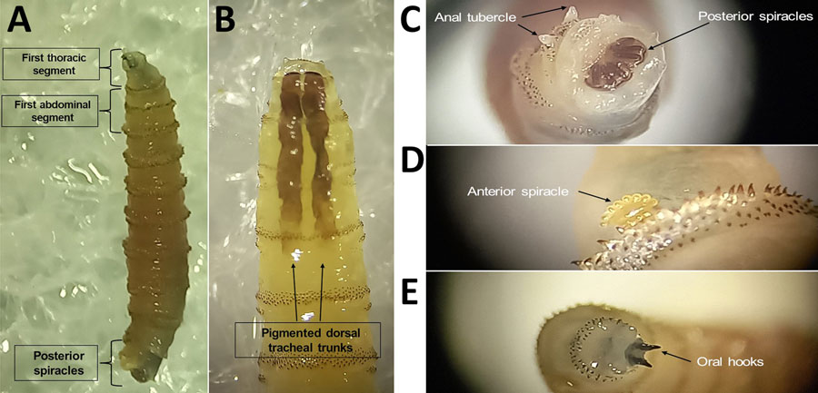 Cochlyiomia hominivorax larvae collected from a case of New World screwworm infestation in wild mountain tapir, Central Andes Mountains, Colombia. The larvae were collected from a male tapir and depict features used for taxonomic identification. A) Full larva, showing morphologic features; original magnification ×5. B) First thoracic section, demonstrating pigmented dorsal tracheal trunks; original magnification ×10. C) Posterior spiracles and anal tubercle; original magnification ×25. D) Anterior spiracle; original magnification ×25. E) Oral hooks from first thoracic segment; original magnification ×25. Photographs were taken at the Laboratorio de Parasitología Veterinaria, Universidad Nacional de Colombia, by using an SZX12 stereomicroscope (Olympus, https://www.olympus-lifescience.com).