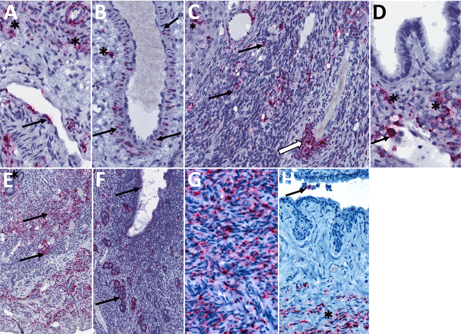 Detection of Lassa virus (LASV) antigens and RNA in reproductive tissues by immunohistochemistry (IHC) and in situ hybridization (ISH) in strain 13/N female guinea pigs lethally infected with LASV strain Josiah in study of guinea pig model for LASV infection of reproductive tract and considerations for sexual and vertical transmission. IHC and ISH chromogens are red. A) Uterus (25 dpi), ISH. Staining in interstitial mesenchymal cells (asterisks) and rare endothelial cells (arrow). B) Uterus (23 dpi), ISH. Staining in vascular smooth muscle cells (arrows) and perivascular interstitial mesenchymal cells (asterisk). C) Ovary (23 dpi), ISH. Staining within a corpus luteum (asterisk), in theca-interstitial cells (arrows), and in inflammatory cells within and around a vascular wall (white arrow). D) Oviduct (23 dpi), ISH. Staining in mesenchymal interstitial cells (asterisk) and intravascular inflammatory cells (arrow). E) Uterus (23 dpi), ISH. Extensive staining in the endometrial stroma (asterisk) and myometrial smooth muscle cells (arrows). F) Uterus (23 dpi), ISH. Extensive staining in the endometrial glandular epithelial cells (arrows). G) Endocervix (23 dpi), IHC. Extensive staining in mesenchymal cells. H) Vagina (23 dpi), IHC. Staining in submucosal mesenchymal cells (asterisk) and intraluminal cellular debris (arrow). Original magnifications ×40 (panels A, B, D, G, H), ×30 (panel C), ×20 (panels E, F). 