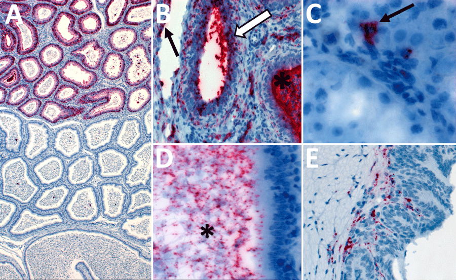 Detection of Lassa virus (LASV) antigens and RNA in reproductive tissues by immunohistochemistry (IHC) and in situ hybridization (ISH) in strain 13/N male guinea pigs lethally infected with LASV strain Josiah in study of guinea pig model for LASV infection of reproductive tract and considerations for sexual and vertical transmission. A) Epididymis (18 dpi), ISH. Regionally extensive staining in epididymal epithelial cells. B) Epididymis (26 dpi), ISH. Staining in interstitial mesenchymal cells, endothelium (arrow), tubular epithelium (white arrow), and intratubular inflammatory cells (asterisk). C) Testis (18 dpi), ISH. Focal intracellular staining in the interstitium (arrow). D) Epididymis (23 dpi), ISH. Intraluminal staining including spermatozoa (asterisk). E) Seminal vesicle (17 dpi), ISH. Focal staining in subepithelial stromal cells. Original magnifications ×5 (panel A), ×40 (panels B, D), ×63 (panel C), ×20 (panel E).
