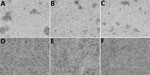 Ephrin-B2 and ephrin-B3 host cell receptor usage from a study investigating a novel henipavirus, Salt Gully virus (SGV), isolated from pteropid bats, Australia. Three cell lines—HeLa-USU, recombinant HeLa-USU expressing ephrin-B2, and HeLa-USU expressing ephrin-B3—were inoculated with SGV and observed daily for viral cytopathic effects (CPE). CPE was seen in all 3 cell lines by 5 dpi, indicating that SGV does not use ephrin-B2 or ephrin-B3 as a host cell receptor. A) Uninfected HeLa-USU cells; B) uninfected HeLa-USU cells expressing ephrin-B2; C) uninfected HeLa-USU cells expressing ephrin-B3; D) SGV-infected HeLa-USU cells; E) SGV-infected HeLa-USU ephrin-B2 cells; and F) SGV-infected HeLa-USU ephrin-B3 cells. Scale bars indicate 400um.