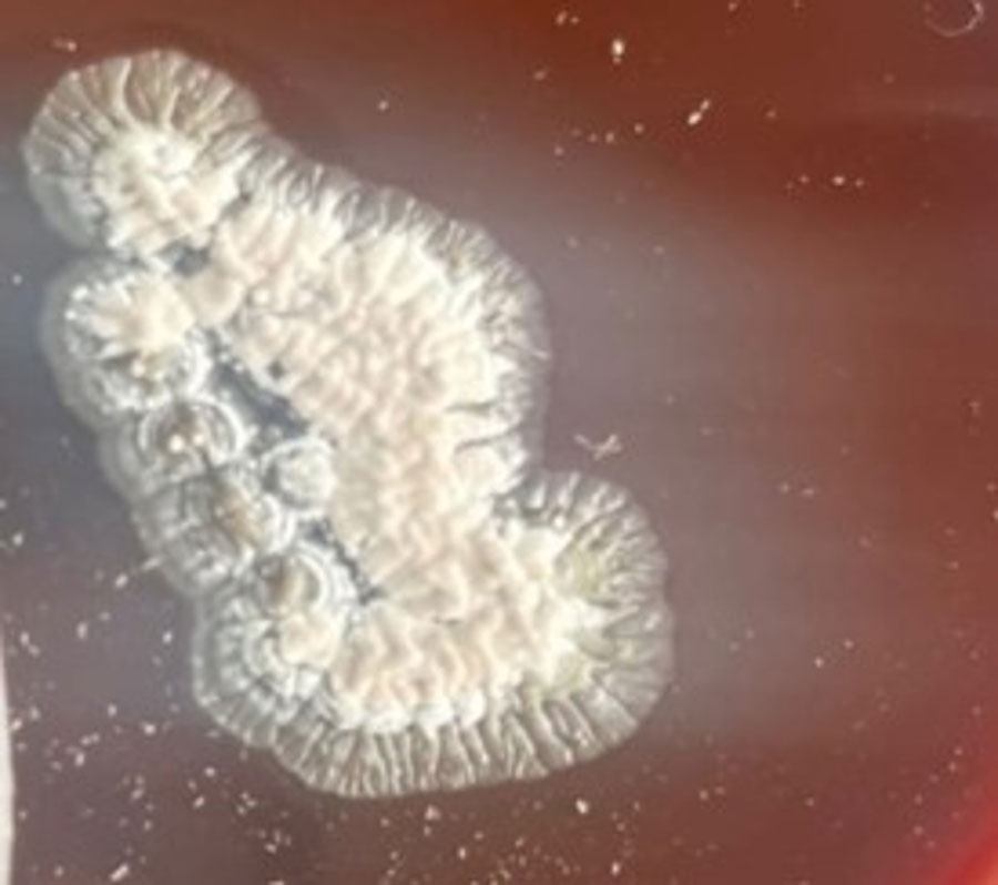 Tissue culture from patient treated with linezolid and meropenem for Nocardia otitidiscaviarum actinomycetoma, India. Blood agar culture shows growth of dry, convex, white colonies that are adherent to the medium. Original magnification ×200.