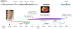 Timeline for reported case of early disseminated Lyme borreliosis with multiple erythema migrans and hepatitis in a 62-year-old immunosuppressed patient treated with venetoclax and obinutuzumab, Switzerland. ALP, alkaline phosphatase; ALT, alanine transaminase; AST, aspartate transferase; CRP, C-reactive protein; GGT, gamma-glutamyl transferase; mNGS, metagenomic next-generation sequencing.