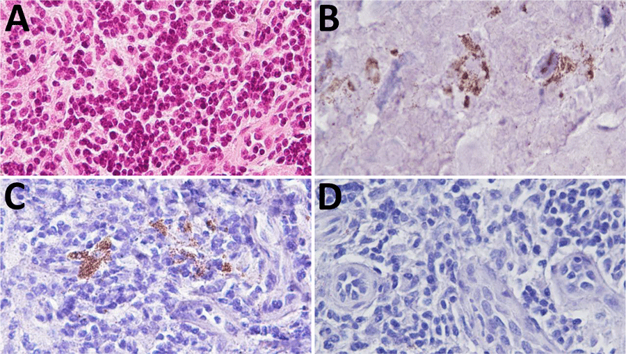Immunohistochemistry for abnormal disease-associated prion protein (PrPTSE) and CD21 on inguinal lymph node of macaque 98CO19 for study investigating abnormal prion protein in nasal swab specimens of macaques infected with Creutzfeldt-Jakob disease. Adjacent sections were stained with hematoxylin-eosin (A); immunostained for PrPTSE (B) and CD21 (C); and probed without primary antibody as negative control (D). Original magnification ×40.