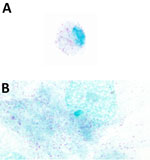 Microscopic images from study of isolation and characterization of Rickettsia finnyi, novel pathogenic spotted fever group Rickettsia in dogs, United States. Images depict Rickettsia finnyi sp. nov. strain 2024-CO-Wats–infected 030D canine mononuclear cells (A) and Vero E6 primate epithelial cells (B) stained with Giménez. Original magnification ×100. Image is white balance adjusted.