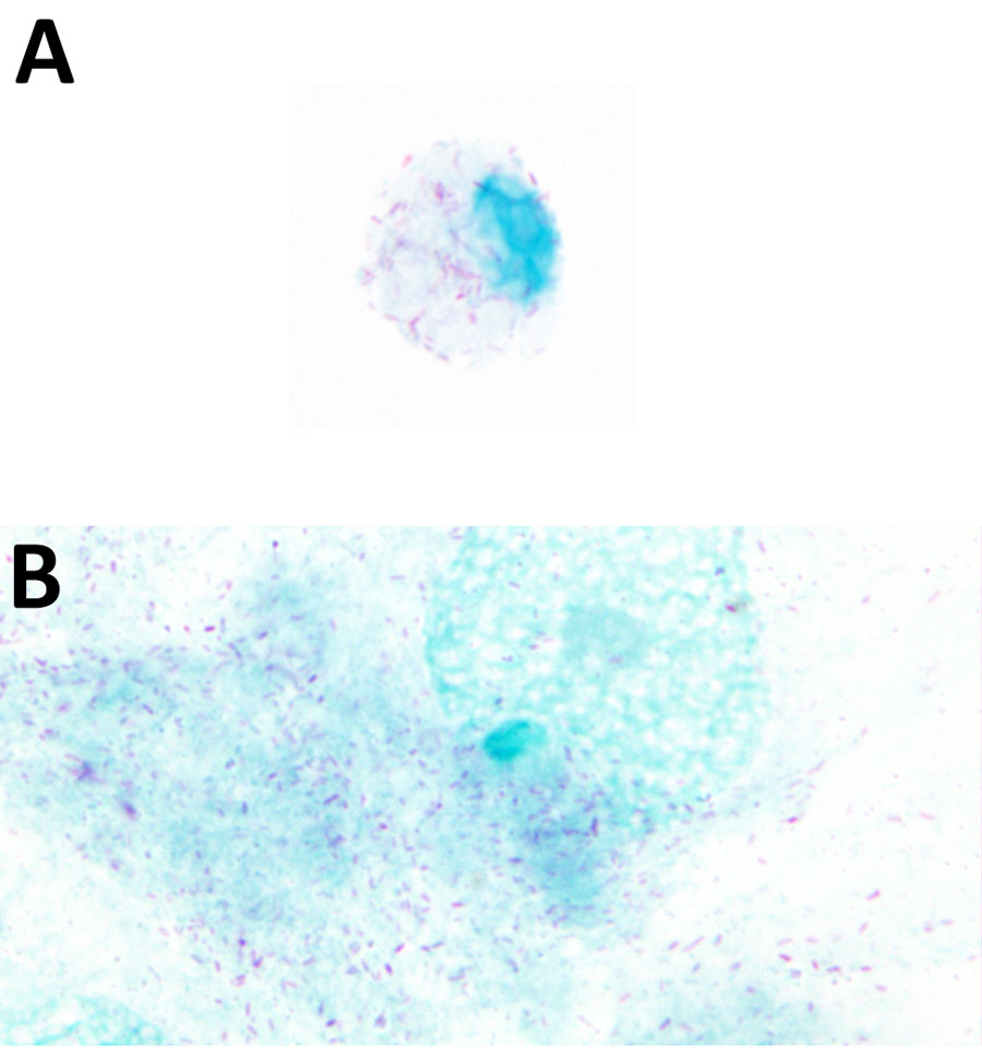 Microscopic images from study of isolation and characterization of Rickettsia finnyi, novel pathogenic spotted fever group Rickettsia in dogs, United States. Images depict Rickettsia finnyi sp. nov. strain 2024-CO-Wats–infected 030D canine mononuclear cells (A) and Vero E6 primate epithelial cells (B) stained with Giménez. Original magnification ×100. Image is white balance adjusted.