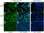 Microscopic images from study of isolation and characterization of Rickettsia finnyi, novel pathogenic spotted fever group Rickettsia in dogs, United States. Images depict R. finnyi sp. nov. strain 2024-CO-Wats–infected 030D canine mononuclear cells (A–C), DH82 canine histiocytic cells (D–F), and Vero E6 primate epithelial cells (G–I) detected by immunofluorescence using R. finnyi sp. nov.–seroreactive canine serum (dog 2, May 15 date from Table 2). Scale bar indicates 20 µm. SFGR nonreactive canine serum was used as a negative control. Green represents 2024-CO-Wats organisms. Blue represents nuclei of individual mammalian host cells (DAPI). SFGR, spotted fever group Rickettsia.