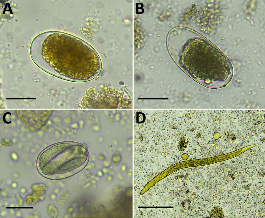 Light microscopy images of soil-transmitted helminths from human stool samples, Gabon. A, B) Hookworm eggs; scale bars indicate 25 µm. C) Strongyloides spp. eggs; scale bar indicates 25 µm. D) Strongyloides spp. larvae; scale bar indicates 50 µm. Helminths were detected by using the formalin ethyl acetate sedimentation method. Molecular analysis of ethanol-preserved stool sample aliquots from the same patients indicated Necator americanus (A), N. gorillae (B), Strongyloides fuelleborni fuelleborni (C), and S. stercoralis (D).