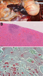 Gross and histopathological features of nonhuman primates who died during rapidly progressing melioidosis outbreak in city center zoo, Hong Kong, 2024. A) Gross pathology of splenic lesion in a white-faced saki (Pithecia pithecia). The spleen exhibits multifocal to coalescing necrosis. B) Necrotizing hepatitis of the liver in a cotton-top tamarin (Saguinus oedipus). Hematoxylin and eosin stain; original magnification ×200. C) Numerous gram-negative rods (black arrow) at the areas of necrosis in the liver of a cotton-top tamarin. Gram stain; original magnification ×1,000 with oil immersion objective.