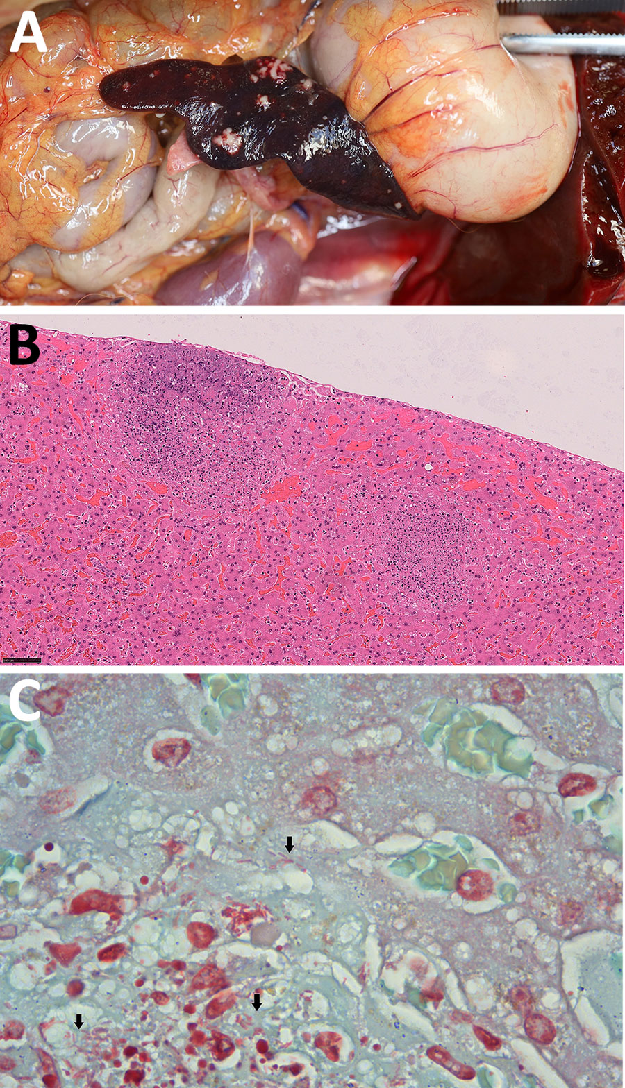 Gross and histopathological features of nonhuman primates who died during rapidly progressing melioidosis outbreak in city center zoo, Hong Kong, 2024. A) Gross pathology of splenic lesion in a white-faced saki (Pithecia pithecia). The spleen exhibits multifocal to coalescing necrosis. B) Necrotizing hepatitis of the liver in a cotton-top tamarin (Saguinus oedipus). Hematoxylin and eosin stain; original magnification ×200. C) Numerous gram-negative rods (black arrow) at the areas of necrosis in the liver of a cotton-top tamarin. Gram stain; original magnification ×1,000 with oil immersion objective.