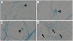 Images of Bjerkandera spp. formations from study of Bjerkandera spp. pulmonary infection in immunocompromised hosts, Germany. Slides are of lactophenol preparation (original magnification ×1,000). Bjerkandera spp. form white, yellowish-white, or tan colonies with a cottony to woolly texture on malt extract agar. The hyphae can be branched. Thin-walled, rectangular arthroconidia are formed via schizolytic dehiscence. In addition, ellipsoidal chlamydospores <10 µm long may develop. Arrowheads indicate chlamydospores (A–C), arrows indicate arthroconidia (D).