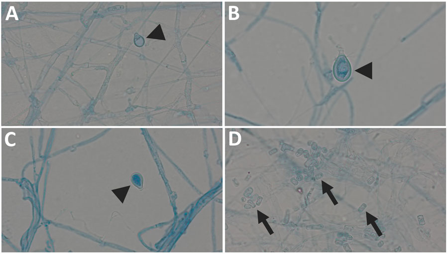 Images of Bjerkandera spp. formations from study of Bjerkandera spp. pulmonary infection in immunocompromised hosts, Germany. Slides are of lactophenol preparation (original magnification ×1,000). Bjerkandera spp. form white, yellowish-white, or tan colonies with a cottony to woolly texture on malt extract agar. The hyphae can be branched. Thin-walled, rectangular arthroconidia are formed via schizolytic dehiscence. In addition, ellipsoidal chlamydospores <10 µm long may develop. Arrowheads indicate chlamydospores (A–C), arrows indicate arthroconidia (D).
