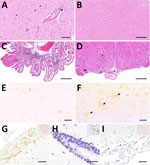 Representative changes and composition of immune cells in the central nervous system of Borna disease virus 1–infected hedgehogs in study of the virus as cause of fatal meningoencephalomyelitis in wild hedgehogs, Germany, 2022–2025. A) Multifocal lymphohistiocytic infiltrates with perivascular cuff formation (arrow) and microgliosis (arrowheads) from case 7. Scale bar represents 100 μm. B) Low-magnification section of brainstem from case 7 showing marked hypercellularity, with scattered lymphocytic infiltrates intermingled with astro- and microgliosis. Scale bar represents 250 μm. C, D) Infiltrates also extend into the choroid plexus in case 6 (C) and the subarachnoid space (arrowheads), nerve roots (arrow) and spinal white matter (asterisk) from case 5 (D). Scale bars represent 250 μm. E) CD3 immunohistochemistry of the corresponding brainstem region shown in Figure 1, panel B, confirms the widespread T lymphocyte infiltration, comprising the most invading immune cells. Scale bar represents 250 μm. F) The second most prominent cells involved in antiviral responses are Iba1-positive microglial cells and macrophages (arrows) from case 7. Scale bar represents 200 μm. G) Subarachnoid spaces contain numerous CD3-positive T lymphocytes in case 7. Scale bar represents 50 μm. H) Pax-5 positive B lymphocytes (arrowheads) resemble a minority of immune cells that are here seen concentrated around a blood vessel (arrowheads) from case 1. Scale bar represents 25 μm. I) Scattered Iba1-positive macrophages within subarachnoid spaces from case 7. Scale bar represents 50 μm. Insets in figures G, H, and I show the positive controls for each respective immunohistochemical staining (original magnification ×20). Stains: panels A–D, hematoxylin and eosin; E–I, 3,3′-diaminobenzidine, hematoxylin counterstain, immunohistochemistry using markers; E, CD3; F, Iba1; G, CD3; H, Pax5; I, Iba1.