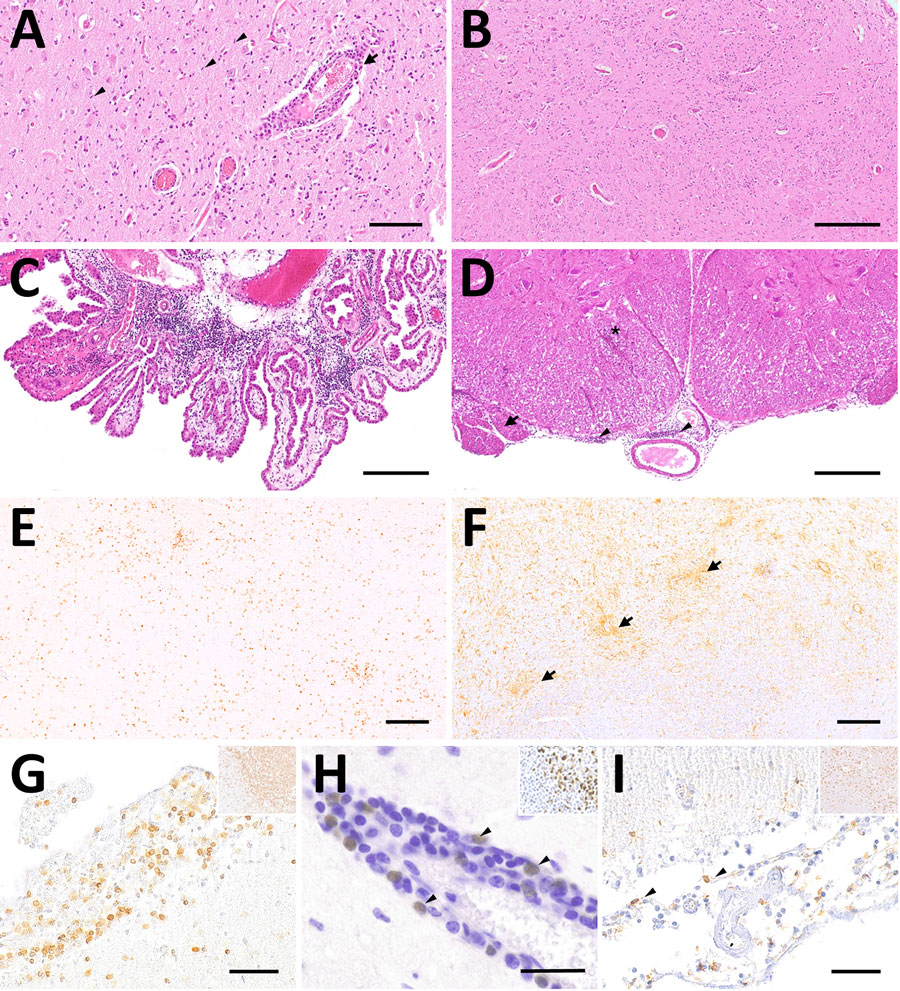 Representative changes and composition of immune cells in the central nervous system of Borna disease virus 1–infected hedgehogs in study of the virus as cause of fatal meningoencephalomyelitis in wild hedgehogs, Germany, 2022–2025. A) Multifocal lymphohistiocytic infiltrates with perivascular cuff formation (arrow) and microgliosis (arrowheads) from case 7. Scale bar represents 100 μm. B) Low-magnification section of brainstem from case 7 showing marked hypercellularity, with scattered lymphocytic infiltrates intermingled with astro- and microgliosis. Scale bar represents 250 μm. C, D) Infiltrates also extend into the choroid plexus in case 6 (C) and the subarachnoid space (arrowheads), nerve roots (arrow) and spinal white matter (asterisk) from case 5 (D). Scale bars represent 250 μm. E) CD3 immunohistochemistry of the corresponding brainstem region shown in Figure 1, panel B, confirms the widespread T lymphocyte infiltration, comprising the most invading immune cells. Scale bar represents 250 μm. F) The second most prominent cells involved in antiviral responses are Iba1-positive microglial cells and macrophages (arrows) from case 7. Scale bar represents 200 μm. G) Subarachnoid spaces contain numerous CD3-positive T lymphocytes in case 7. Scale bar represents 50 μm. H) Pax-5 positive B lymphocytes (arrowheads) resemble a minority of immune cells that are here seen concentrated around a blood vessel (arrowheads) from case 1. Scale bar represents 25 μm. I) Scattered Iba1-positive macrophages within subarachnoid spaces from case 7. Scale bar represents 50 μm. Insets in figures G, H, and I show the positive controls for each respective immunohistochemical staining (original magnification ×20). Stains: panels A–D, hematoxylin and eosin; E–I, 3,3′-diaminobenzidine, hematoxylin counterstain, immunohistochemistry using markers; E, CD3; F, Iba1; G, CD3; H, Pax5; I, Iba1.