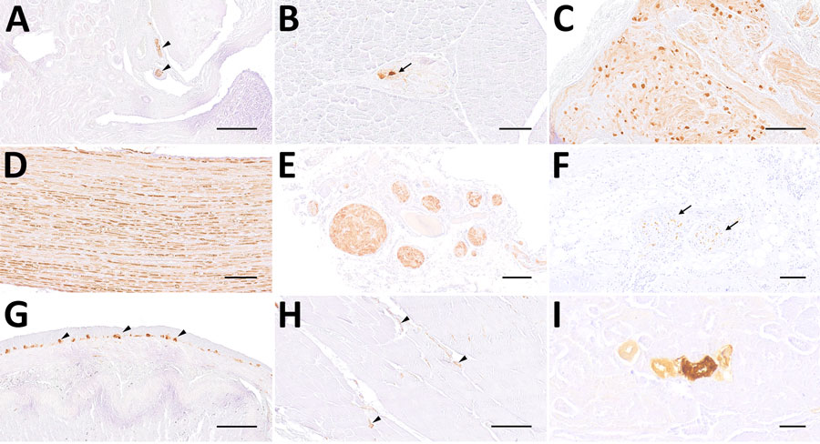 Distribution of virus antigen detected by immunohistochemistry using Bo18 antibody among peripheral organs and tissues of Borna disease virus 1–infected hedgehogs in study of the virus as cause of fatal meningoencephalomyelitis in wild hedgehogs, Germany, 2022–2025. A) Immunopositive nerve branches within the renal pelvis (arrowheads) from case 3. Scale bar represents 250 μm. B) Immunopositive ganglion neurons within salivary gland (arrow) from case 4. Scale bar represents 100 μm. C) Marked positivity within cranial mesenteric ganglion from case 3. Scale bar represents 250 μm. D) Diffusely immunopositive nerve fibers within a large fascicular nerve from case 1. Scale bar represents 100 μm. E) Large immunopositive visceral nerve branches within the mediastinum from case 2. Scale bar represents 200 μm. F) Pulmonary nerve branches with positive fibers (arrows) from case 7. Scale bar represents 100 μm. G) Widespread immunostaining of myenteric plexus (arrowheads) from case 4. Scale bar represents 250 μm. H) Immunopositive intramuscular nerve branches within the paravertebral musculature (arrowheads) from case 5. Scale bar represents 250 μm. I) A small group of immunopositive renal tubules from case 5. Scale bar represents 50 μm. All stains were 3,3′-diaminobenzidine stain with, hematoxylin counterstain.