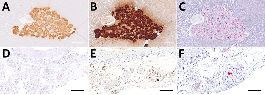 Comparison of 3 diagnostic methods, in the adrenal glands (A–C) and mediastinal nerve branches (D–F) of case 5, a hedgehog from Germany with Borna disease virus 1 (BoDV-1) infection, in study of the virus as cause of fatal meningoencephalomyelitis in wild hedgehogs, Germany, 2022–2025. Diffusely positive chromaffin cells and multifocal positive nerve branches are seen by immunohistochemistry by using BoDV-1 nucleoprotein mouse monoclonal antibody Bo18 (A, D), rabbit anti–BoDV-1 nucleoprotein polyclonal hyperimmune serum #201 (B, E) and RNAscope (Advanced Cell Diagnostics, Inc., https://acdbio.com) in situ hybridization (C, F). Scale bars: A–C, 250 μm; D–F, 100 μm. Stains: A, B, D, E, 3,3′-diaminobenzidine stain with hematoxylin counterstain; C, F, 2.5 HD assay–RED with hematoxylin counterstain.