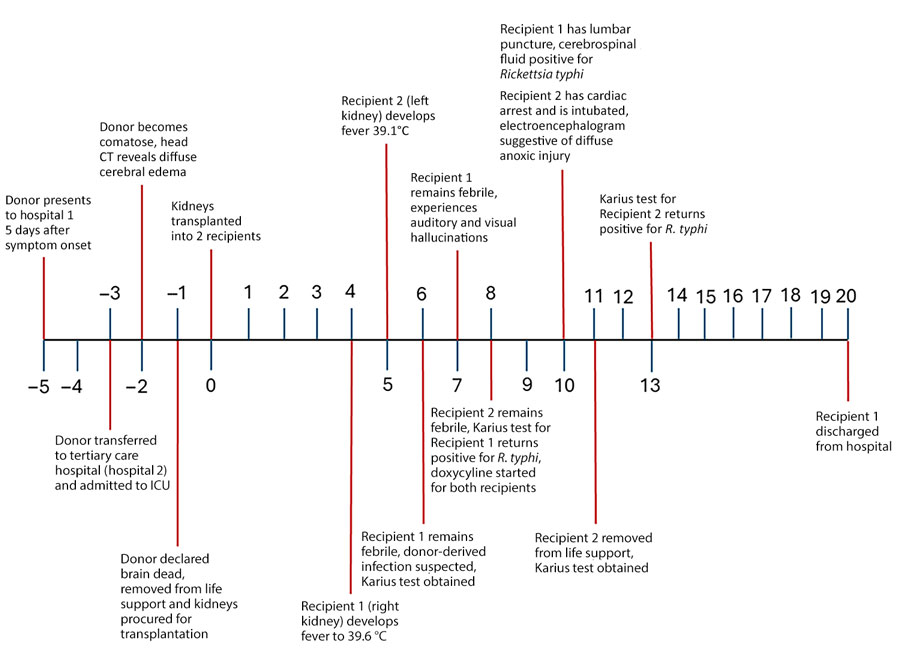 Timeline describing the transmission of Rickettsia typhi from an organ donor to 2 kidney transplant recipients, Texas, 2024. Day 1 of donor hospitalization is represented as −5, the day of death as −1, and the day of transplantation as 0, after which posttransplant days are listed, ending with the discharge of recipient 1 from the hospital on posttransplant day 20. CT, computed tomography; ICU, intensive care unit; Karius, https://kariusdx.com.
