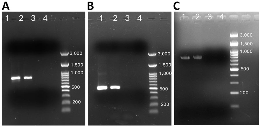 PCR amplification of DNA from an extraintestinal Entamoeba moshkovskii infection in a patient from eastern India. A) PCR amplification of the 18S rRNA locus of E. moshkovskii using DNA extracted from a splenic aspirate. The expected product size is 779 bp. B) PCR amplification of the chitinase locus of E. moshkovskii using DNA extracted from spleen aspirate samples. The expected product size is 480 bp. C) Amplification of the 18S rRNA locus of E. moshkovskii by PCR using DNA extracted from a stool sample. The expected product size is 779 bp. Lane 1, PCR product from patient sample; lane 2, positive control (E. moshkovskii genomic DNA); lane 3, E. histolytica genomic DNA; lane 4, negative control.