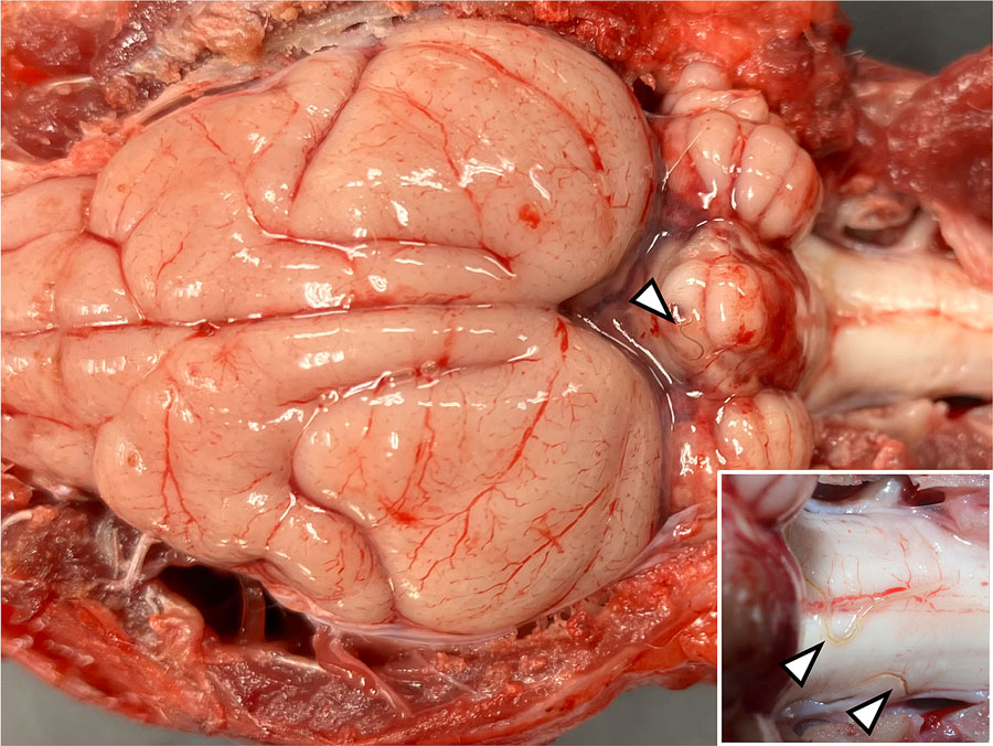 Brain and cervical spinal cord tissue from a parma wallaby (Notamacropus parma) with autochthonous rat lungworm Angiostrongylus cantonensis infection, San Diego, California, USA, 2024. The dorsal and caudal aspects of the cerebellum have coalescing foci of hemorrhage with nematodes (arrows) on the leptomeningeal surface. The inset depicts an enlarged view of the dorsal aspect of brainstem and C1 spinal cord with visible nematodes (arrows).
