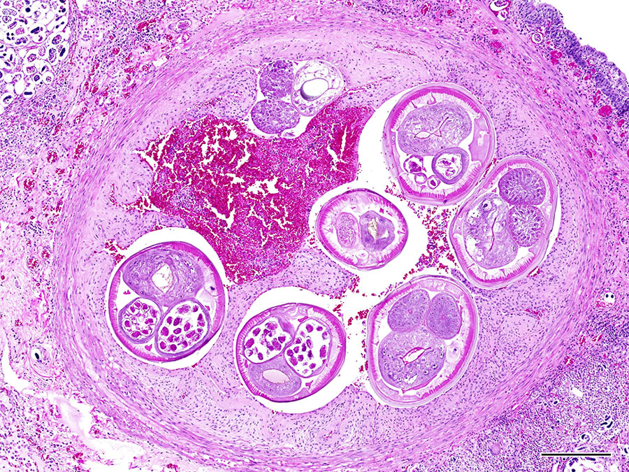 Lung tissue from a roof rat (Rattus rattus) with autochthonous rat lungworm Angiostrongylus cantonensis infection, San Diego, California, USA, 2025. Hematoxylin and eosin stain of pulmonary arteries with intravascular adult metastrongyle nematodes have severe endothelial proliferation. The surrounding lung parenchyma is replaced by granulomatous inflammation centered on numerous larvated and morulated eggs. Scale bar indicates 250 µm.