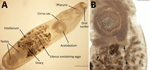 Specimen of Philophthalmus lacrymosus fluke extracted from conjunctiva of a female traveler from England in Chile. A) Full view of the unstained specimen showing oral sucker, pharynx, cirrus sac, acetabulum, uterus containing eggs, ovary, testes, and vitellarium. B) Intrauterine eggs showing fully formed miracidia with eyespots (arrows).