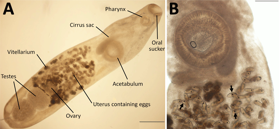 Specimen of Philophthalmus lacrymosus fluke extracted from conjunctiva of a female traveler from England in Chile. A) Full view of the unstained specimen showing oral sucker, pharynx, cirrus sac, acetabulum, uterus containing eggs, ovary, testes, and vitellarium. B) Intrauterine eggs showing fully formed miracidia with eyespots (arrows).