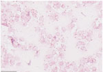 Gram stain of positive blood culture from patient in case 1 in report of Sphingobacterium hotanense infections in immunocompromised patients, Minnesota, USA. Numerous gram-negative bacilli are shown (pink rods), representing S. hotanense infection. Scale bar indicates 20 μm.