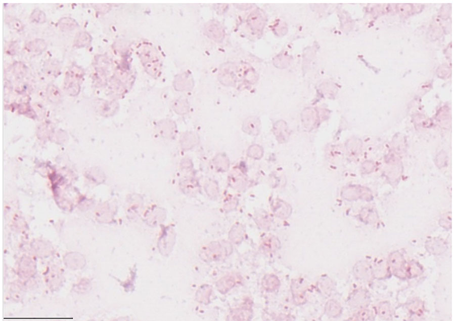 Gram stain of positive blood culture from patient in case 1 in report of Sphingobacterium hotanense infections in immunocompromised patients, Minnesota, USA. Numerous gram-negative bacilli are shown (pink rods), representing S. hotanense infection. Scale bar indicates 20 μm.