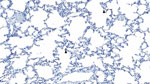 Histopathology of lung from a naturally infected flying fox from a study of natural Hendra virus infections in captive Australian black flying foxes, Queensland, Australia. Immunohistochemistry of bat 4, left caudal lung lobe for Hedra virus (nucleocapsid protein) using a cross-reactive Nipah virus nucleocapsid polyclonal antisera showing scattered interstitial mononuclear cells with finely granular cytoplasmic immunolabelling (arrowhead). Original magnification ×200.