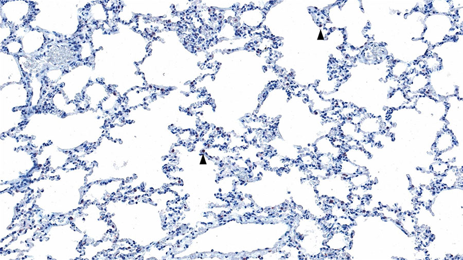 Histopathology of lung from a naturally infected flying fox from a study of natural Hendra virus infections in captive Australian black flying foxes, Queensland, Australia. Immunohistochemistry of bat 4, left caudal lung lobe for Hendra virus (nucleocapsid protein) using a cross-reactive Nipah virus nucleocapsid polyclonal antisera showing scattered interstitial mononuclear cells with finely granular cytoplasmic immunolabelling (arrowhead). Original magnification ×200.