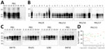 Detection and characterization of the PrPres of scrapie prion protein (PrPSc) from brain tissues of dromedary camels, Tunisia, 2019–2021. A) PrPres detected using TeSeE Western blot kit (Bio-Rad Laboratories, https://www.bio-rad.com). Membrane probed with the Sha31 monoclonal antibody. Loading order (left to right): ovine scrapie control, Tunisian camel prion disease–positive cases (animal no. P81/9–65) and Tunisian camel prion disease–negative samples (animal nos. P81/64 and P81/15). All samples, except for P81/64 and P81/15, were diluted 1:4 prior to electrophoresis and loaded at 3.75 mg tissue equivalent per lane. The negative samples were loaded at 15 mg tissue equivalent per lane. Approximate molecular weights (expressed in kDa) are reported at top of blot. B) Representative Western blot analysis of different available brain regions from selected positive cases. Brain tissues analyzed using the ISS (Istituto Superiore di Sanità) discriminatory Western blot protocol. Case identifiers indicated below each blot. Corresponding brain regions labeled at the top: a, striatum; b, frontal cortex; c, prefrontal cortex; d, capsule; e, occipital cortex; f, parietal cortex; g, cerebellar peduncle; h, cerebellum; i, temporal cortex; j, basal ganglia; k, thalamus; l, hippocampus; m, midbrain; n, medulla oblongata; o, hypothalamus; p, pons; q, scrapie. All membranes probed with the 12B2 antibody, except for P81/17, which was probed with L42. Tissue equivalents loaded per lane: 2 mg for P81/9 and 0.5 mg for P81/13, P81/16, and P81/17. Molecular weights (in kDa) are indicated on the left of blot. C) Representative replica blots showing the epitope mapping analysis of PrPres from brain homogenates of positive dromedary camel cases. A preliminary assessment of dromedary PrPres reactivity with a panel of monoclonal antibodies was performed to identify suitable diagnostic tools for camel prion disease and to characterize PrPres. Within each antibody group, the antibody with the best sensitivity toward dromedary PrPSc was chosen for epitope mapping (Appendix Table 2, Figure 1). In addition, the SAF32 antibody, which targets the octarepeat region, was included to enable comparison with scrapie, in which this epitope is partially lost. The brain areas analyzed for each sample were as follows: P81/9, prefrontal cortex; P81/13, frontal cortex; P81/14, thalamus; P81/16, parietal cortex; P81/17, prefrontal cortex; P81/65, not identifiable; scrapie, medulla oblongata. A scrapie-affected sheep sample was included as control in last lane of each blot. Molecular weights (expressed in kDa) reported on the left of blot. Membranes were probed with monoclonal antibodies indicated below each blot. D) Relative proportions of diglycosylated, monoglycosylated, and unglycosylated PrPres bands in each available brain region of animal P81/13. Scrapie is shown on the right for comparison. Quantifications were performed on membrane probed with 12B2 antibody. Ctrl, control; PrPres, proteinase K-resistant core.