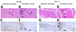 Histopathologic and immunohistochemical analyses of medulla oblungata and cerebellum of dromedary camels, Tunisia, 2019–2021. Images show the analyses performed on medulla oblongata (A, E, C, G) and cerebellum (B, F, D, H) of 2 representative animals (P81/65 and P81/17). Hematoxylin and eosin staining of the obex (A, C) and cerebellar cortex (B, D) revealed spongiform changes in the nucleus of the solitary tract (A, arrows) and in the molecular layer of cerebellar cortex (B, arrows) of P81/65, but no such alterations were observed in P81/17 (C, D). Conversely, immunohistochemistry revealed scrapie prion protein deposition in both animals (E–H), affecting the nucleus of solitary tract (E, G) and cerebellar cortex (F and H). Brown color indicates PrPSc deposition. Brain sections from P81/17 showed partial loss of tissue integrity. Scale bars indicate 20 μm. GL, granular layer; ML, molecular layer; PC, Purkinje cells.