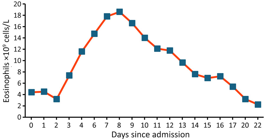 Eosinophil count evolution in recipient A during admission in a study of donor screening failure for Strongyloides stercoralis in solid organ transplantation.