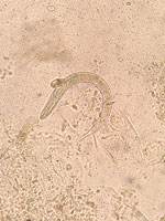 Strongyloides stercoralis L1 rhabditiform larva found in stool sample from recipient A in a study of donor screening failure for Strongyloides stercoralis in solid organ transplantation.