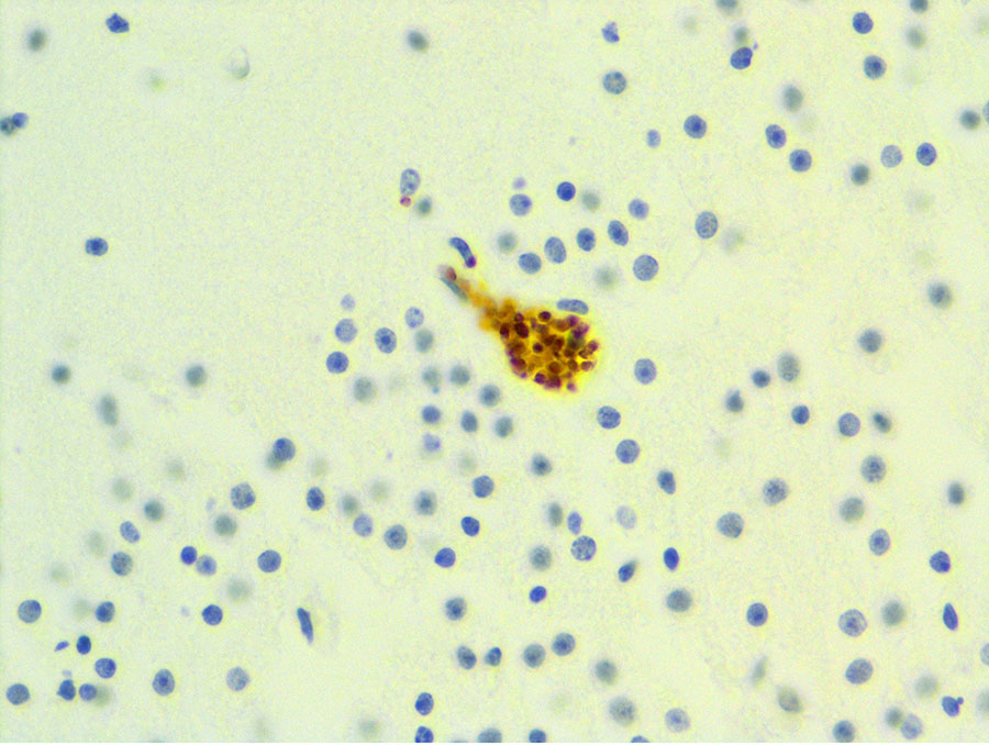 Immunohistochemistry of a harbor seal pup with Neospora caninum antigen localized within a neuron from study of N. caninum infection in marine mammals stranding in the northeastern Pacific Ocean region. Original magnification ×600.