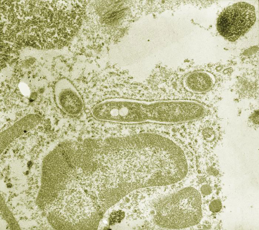Ultrastructural morphology of numerous Legionella pneumophila bacteria in tissue section. Image from wwwn.cdc.gov/phil