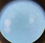 Representative electron micrograph of Helicobacter pylori, showing its spiral shape and polar flagella, which enable motility in the gastric mucus. Original magnification ×1,000. Photograph provided by the authors.