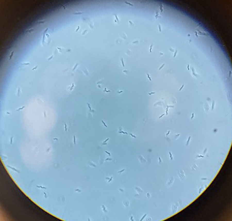 Representative electron micrograph of Helicobacter pylori, showing its spiral shape and polar flagella, which enable motility in the gastric mucus. Original magnification ×1,000. Photograph provided by the authors.