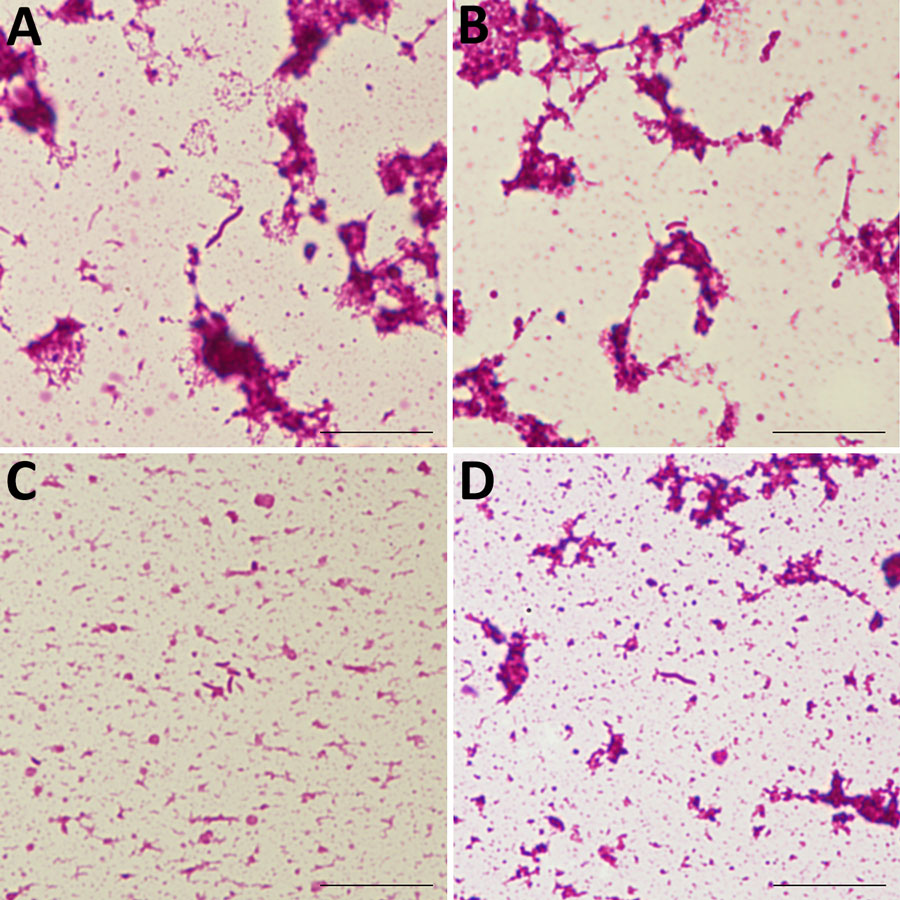 Gram-stained smear from a positive anaerobic blood-culture bottle in a study of Desulfovibrio bacteremia at a tertiary-care hospital in Japan, 2020–2025. A) D. desulfuricans spiral form; B) D. desulfuricans curved form; C) D. falkowii curved form; D) D. legallii spiral form. Curved or spiral gram-negative rods are visible. Images were acquired using a 100× oil-immersion objective. Scale bars indicate 10 μm. 