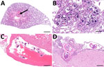 Histopathology of Angiostrongylus cantonensis rat lungworm infection in metropolitan black rats, Houston, Texas, 2024. A) Severe pulmonary consolidation due to verminous pneumonia. Adult nematode is visible within a large artery (arrow). Scale bar = 1.5 mm. B) Higher magnification of lung with numerous A. cantonensis larvae and eggs surrounded by granulomatous inflammation. Scale bar = 80 µm. C) Multiple adult A. cantonensis nematodes in right ventricle of the heart. Scale bar = 1.5 mm. D) Mild lymphoplasmacytic meningitis with cross sections of A. cantonensis nematodes. Scale bar = 300 µm.