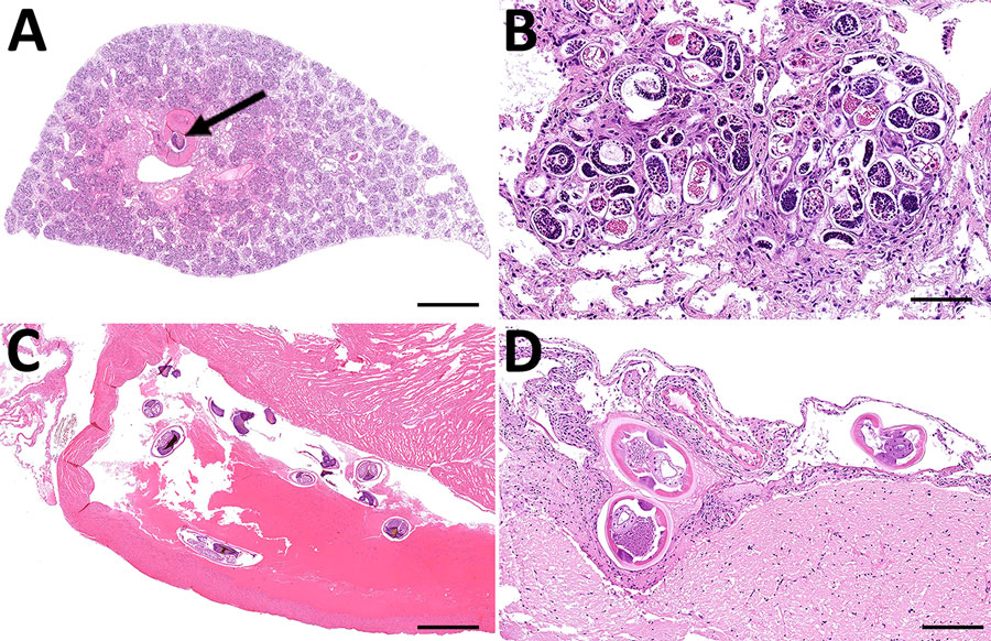 Histopathology of Angiostrongylus cantonensis rat lungworm infection in metropolitan black rats, Houston, Texas, 2024. A) Severe pulmonary consolidation due to verminous pneumonia. Adult nematode is visible within a large artery (arrow). Scale bar = 1.5 mm. B) Higher magnification of lung with numerous A. cantonensis larvae and eggs surrounded by granulomatous inflammation. Scale bar = 80 µm. C) Multiple adult A. cantonensis nematodes in right ventricle of the heart. Scale bar = 1.5 mm. D) Mild lymphoplasmacytic meningitis with cross sections of A. cantonensis nematodes. Scale bar = 300 µm.