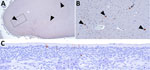 Immunohistochemical stains showing influenza A virus nucleoprotein (NP) antigen detection in pigs at 35 days postinoculation in an area with gliosis in study of systemic distribution and protracted detection of highly pathogenic avian influenza A(H5N1) clade 2.3.4.4b genotype D1.2 virus in swine after experimental inoculation. A) NP antigen within multiple cell types in the cerebrum of animal no. 650 (arrowheads). Original magnification ×40. B) Closer view of boxed area in panel A showing NP antigen within neurons (arrowhead) and glial cell (arrow). Original magnification ×200. C) NP antigen in the cytoplasm and nucleus of the olfactory epithelium of animal no. 649. Original magnification ×200.