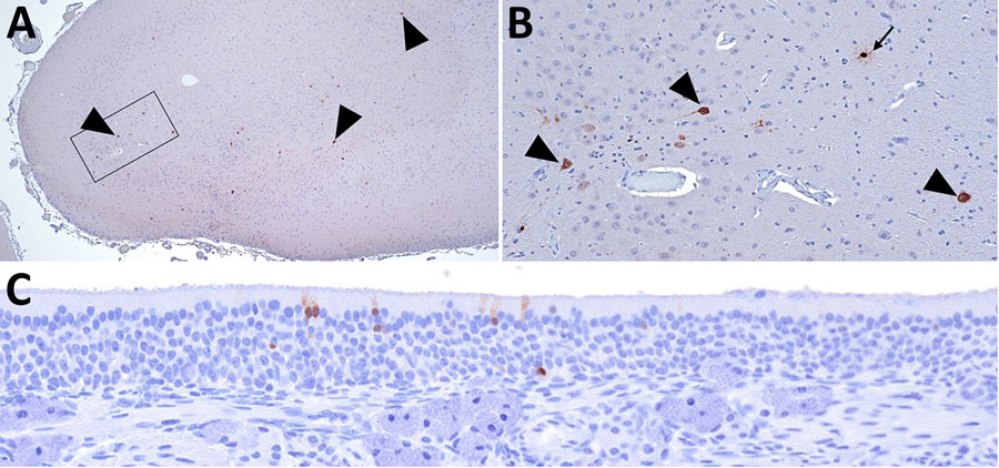 Immunohistochemical stains showing influenza A virus nucleoprotein (NP) antigen detection in pigs at 35 days postinoculation in an area with gliosis in study of systemic distribution and protracted detection of highly pathogenic avian influenza A(H5N1) clade 2.3.4.4b genotype D1.2 virus in swine after experimental inoculation. A) NP antigen within multiple cell types in the cerebrum of animal no. 650 (arrowheads). Original magnification ×40. B) Closer view of boxed area in panel A showing NP antigen within neurons (arrowhead) and glial cell (arrow). Original magnification ×200. C) NP antigen in the cytoplasm and nucleus of the olfactory epithelium of animal no. 649. Original magnification ×200.