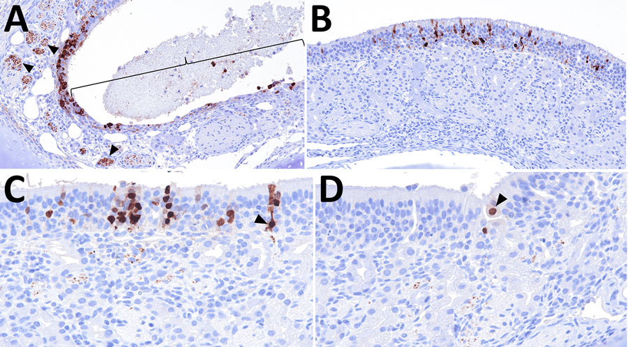 Distribution of influenza A virus nucleoprotein (NP) antigen in the ethmoids of pigs in study of systemic distribution and protracted detection of highly pathogenic avian influenza A(H5N1) clade 2.3.4.4b genotype D1.2 virus in swine after experimental inoculation. At 5 days postinoculation, NP antigen (brown) was detected within the epithelial layer in areas of erosion (brace) and fila olfactoria (panel A, arrowheads; animal no. 641; original magnification ×200) and without (panel B; animal no. 647; original magnification ×200) notable loss of cilia of the ethmoid. Immunolabeling was detected in cells with morphologies consistent with olfactory sensory neurons (panel C; animal no. 642; original magnification ×400) and, rarely, the epithelium of Bowman’s gland (panel D; animal no. 642; original magnification ×400).
