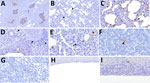 Distribution of influenza A virus nucleoprotein (NP) antigen in the lower respiratory tract and tracheobronchial lymph node of pigs in study of systemic distribution and protracted detection of highly pathogenic avian influenza A(H5N1) clade 2.3.4.4b genotype D1.2 virus in swine after experimental inoculation. At 5 days postinoculation, NP antigen (brown) was detected within the lower respiratory tract and associated lymphoid tissue. Immunolabeling in the lung was detected in the epithelium of conducting airways (panel A, arrowheads; animal no. 647; original magnification ×200), pulmonary alveolar macrophages (panel B; animal no. 645; original magnification ×200) lining the alveolar septa (arrowhead) and type II pneumocytes (brace), probable leukocytes within the bronchus-associated lymphoid tissue (panel D, arrowheads; animal no. 648; original magnification ×400), and leukocytes within the alveolar septa (panel E, arrowhead; animal no. 646; original magnification ×600). Viral antigen was also detected in the nucleus of leukocytes with morphologies consistent with an antigen-presenting leukocyte (panel F; animal no. 645; original magnification ×400) and lymphocyte (panel G; animal no. 646; original magnification ×600) in the tracheobronchial lymph node. NP antigen was only occasionally detected in the epithelial (panel H; animal no. 645; original magnification ×400) and submucosal (panel I; animal no. 643; original magnification ×600) layers of the trachea.