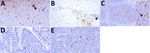 Distribution of influenza A virus nucleoprotein (NP) antigen across multiple body systems in a study of systemic distribution and protracted detection of highly pathogenic avian influenza A(H5N1) clade 2.3.4.4b genotype D1.2 virus in swine after experimental inoculation. NP antigen (brown) was detected at 5 days postinoculation in the neurons (arrowhead) and associated axons (arrows) of the olfactory bulb in the absence of notable lesions (panel A; animal no. 641; original magnification ×400), skeletal myocytes and an adjacent axon (arrowhead) (panel B; animal no. 645; original magnification ×40 and ×400 [inset]), the Peyer’s patch of the ileum in cell morphologies consistent with antigen-presenting leukocytes (arrowhead) and lymphocytes (arrow) (panel C; animal no. 641; original magnification ×100 and ×400 [inset]), and rarely in the lamina propria of the ileum (panel D; animal no. 641; original magnification ×400) and mesenteric lymph node attached to the spiral colon (panel E; animal no. 641; original magnification ×400).