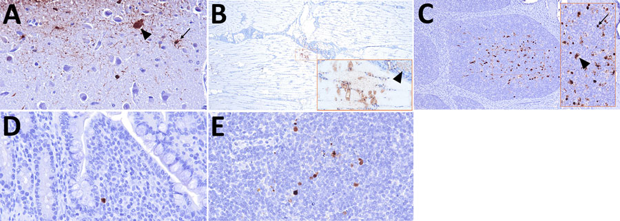 Distribution of influenza A virus nucleoprotein (NP) antigen across multiple body systems in a study of systemic distribution and protracted detection of highly pathogenic avian influenza A(H5N1) clade 2.3.4.4b genotype D1.2 virus in swine after experimental inoculation. NP antigen (brown) was detected at 5 days postinoculation in the neurons (arrowhead) and associated axons (arrows) of the olfactory bulb in the absence of notable lesions (panel A; animal no. 641; original magnification ×400), skeletal myocytes and an adjacent axon (arrowhead) (panel B; animal no. 645; original magnification ×40 and ×400 [inset]), the Peyer’s patch of the ileum in cell morphologies consistent with antigen-presenting leukocytes (arrowhead) and lymphocytes (arrow) (panel C; animal no. 641; original magnification ×100 and ×400 [inset]), and rarely in the lamina propria of the ileum (panel D; animal no. 641; original magnification ×400) and mesenteric lymph node attached to the spiral colon (panel E; animal no. 641; original magnification ×400).