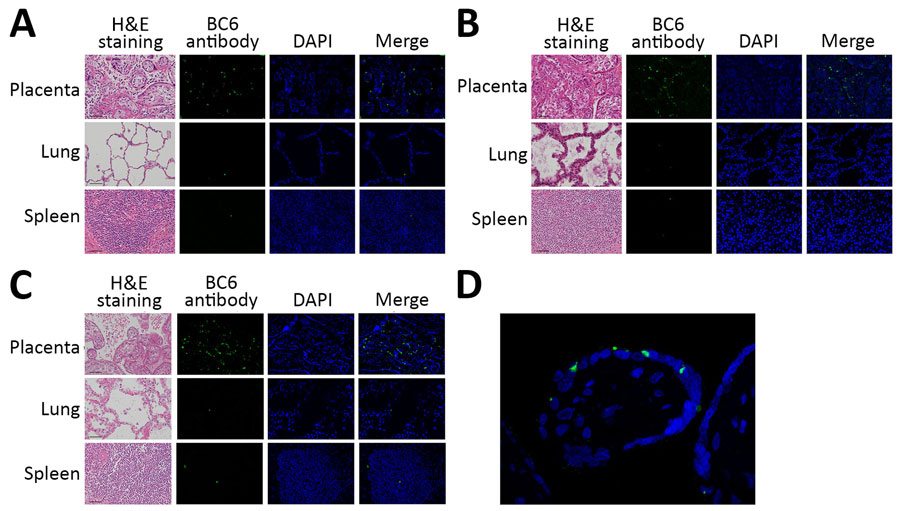 Histologic findings from 3 fatal gestational psittacosis cases caused by C. psittaci strains belonging to closely related multilocus sequence typing lineages, Japan, 2017–2024. A–C) Hematoxylin and eosin staining (scale bar = 50 µm; original magnification ×20) and immunofluorescence microscopy of the placenta, lung, and spleen are shown for case FO-01 (A), case YO-02 (B), and case NO-03 (C). Specific fluorescence observed via immunofluorescence using C. psittaci BC6 rabbit antibody staining. Nuclei were stained with DAPI. Merge column indicates BC6 antibody staining and DAPI. Original magnification ×20. D) High-magnification view (original magnification ×60) of the villi. DAPI, 4′,6-diamidino-2-phenylindole; H&E, hematoxylin and eosin.