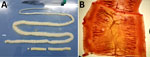 Proglottids of Taenia saginata beef tapeworm collected from an 11-year-old girl in Dili, Timor-Leste, informing an investigation focused on molecular confirmation of autochthonous T. saginata infection, Timor-Leste, 2019. A) Gross morphology of proglottids, showing flat, creamy-white segments, measuring 12–15 mm in length. The scolex was confirmed to lack rostellar hooks on gross examination. Scale bar = 1 cm. B) Acetocarmine-stained proglottid showing 18–20 lateral uterine branches, morphologically consistent with T. saginata tapeworm and excluding T. solium tapeworm. 