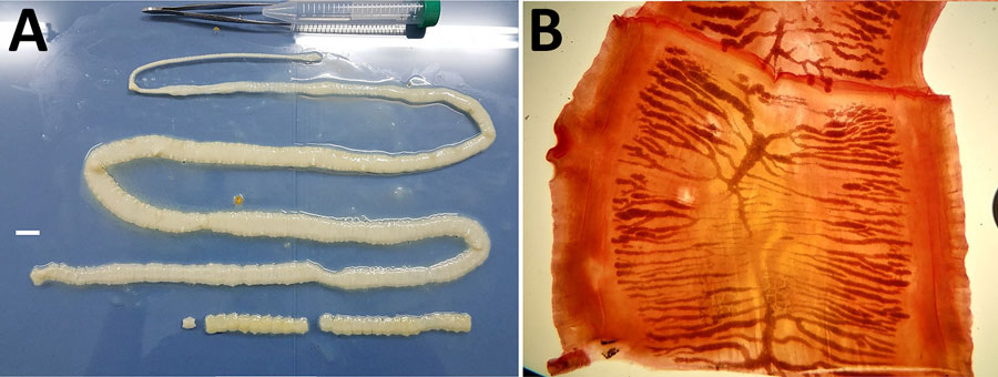 Proglottids of Taenia saginata beef tapeworm collected from an 11-year-old girl in Dili, Timor-Leste, informing an investigation focused on molecular confirmation of autochthonous T. saginata infection, Timor-Leste, 2019. A) Gross morphology of proglottids, showing flat, creamy-white segments, measuring 12–15 mm in length. The scolex was confirmed to lack rostellar hooks on gross examination. Scale bar = 1 cm. B) Acetocarmine-stained proglottid showing 18–20 lateral uterine branches, morphologically consistent with T. saginata tapeworm and excluding T. solium tapeworm. 