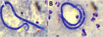 Microfilaria detected in Giemsa-stained thick blood smears from case-patients 1 (A) and 2 (B) in study of Dirofilaria infection and asymptomatic microfilaremia, Sri Lanka, 2025. Red arrows indicate the anterior end (cephalic space) with 2–3 distinct nuclei; yellow arrows indicate the tails free of any nuclei. Original magnification ×1,000.